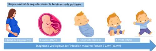 Infections materno-foetales
